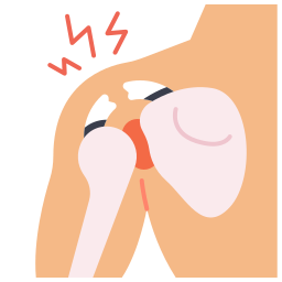 Complex Fracture